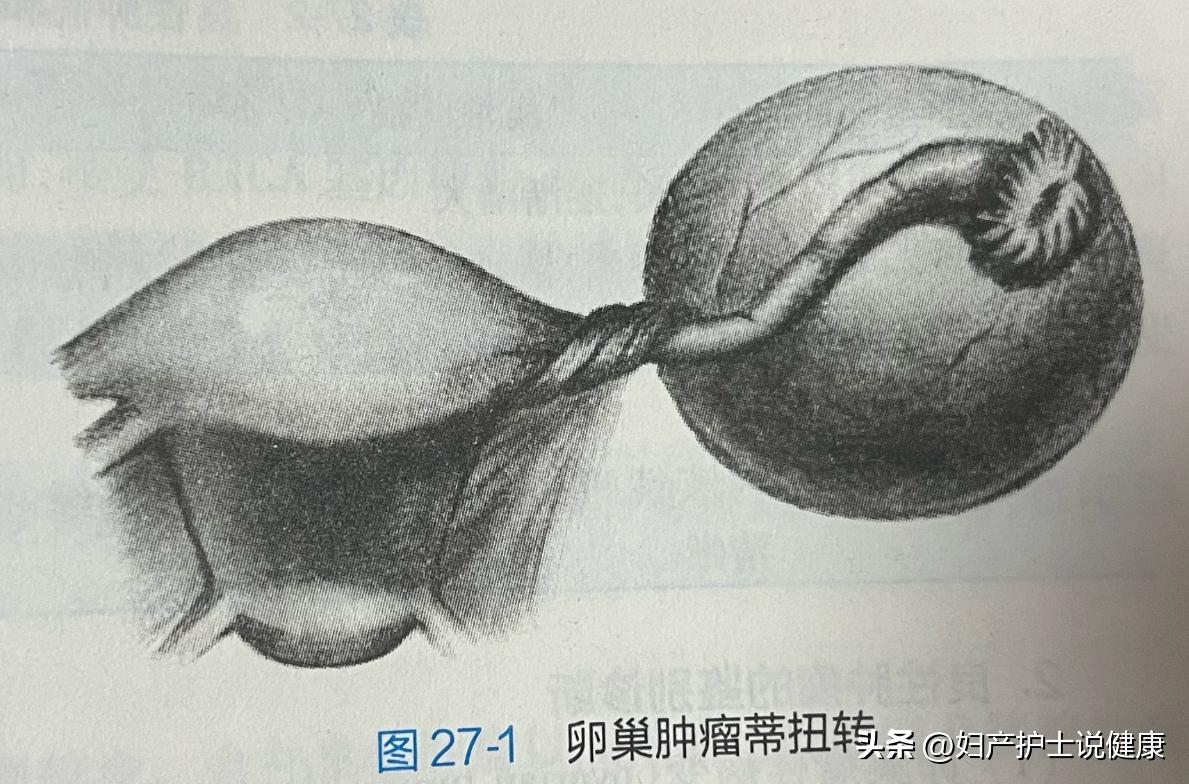 80多岁老太右下腹痛是什么毛病,60岁女人腹部疼痛胀气