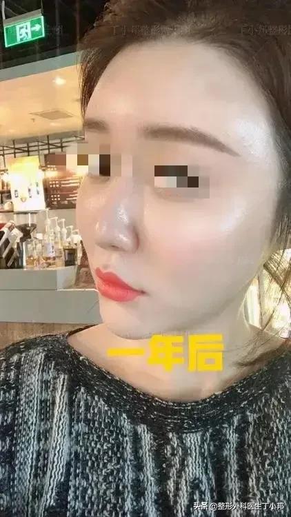 一个小姑娘毁容,一个女的毁容后才知道是救了自己