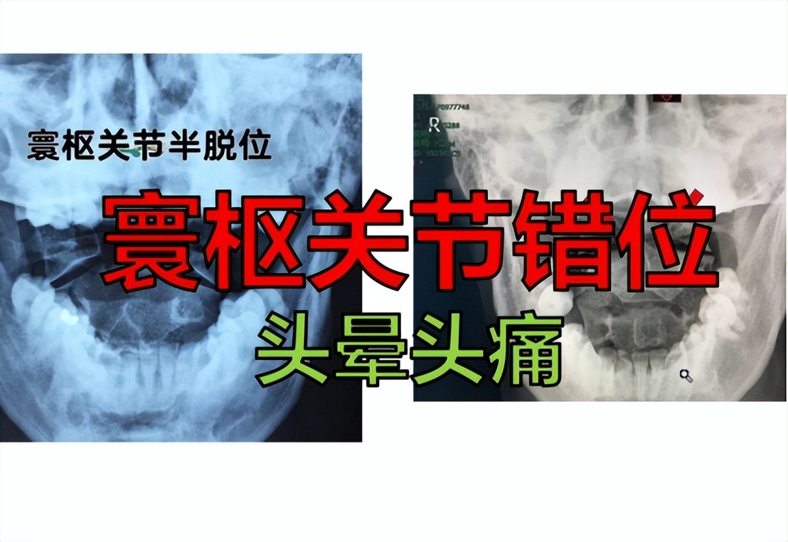 经常头晕中医怎么辨证,头晕中医可以根治吗