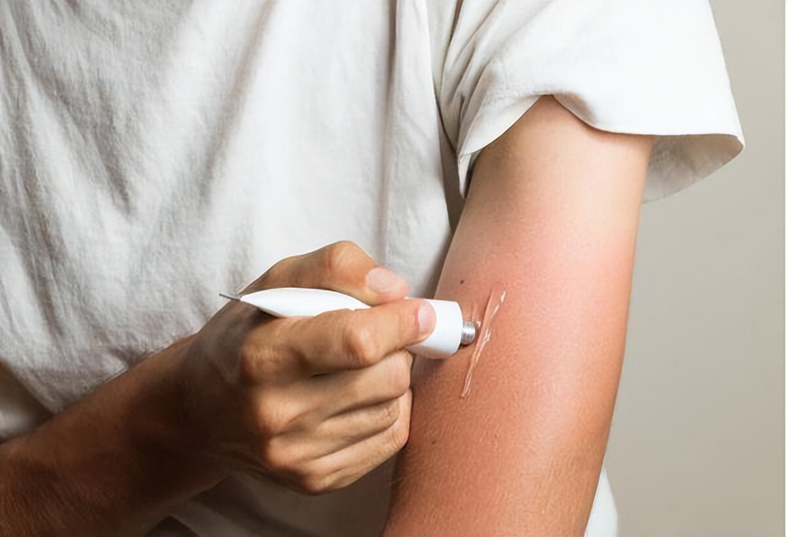 红霉素软膏护肤妙用,红霉素软膏的十大作用