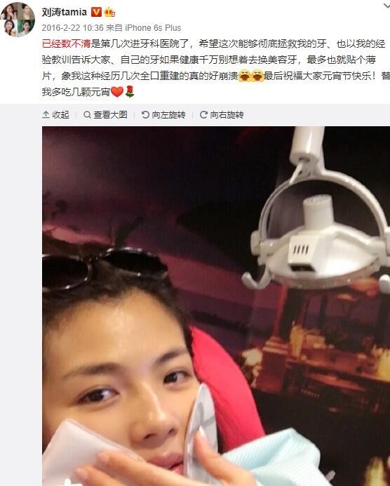 烤瓷牙的明星,烤瓷牙的明星都有谁