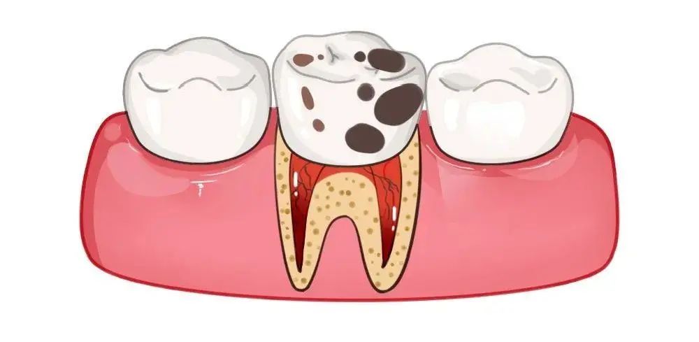 这两天总是咬腮帮子是上火吗,吃饭总咬嘴是预示什么
