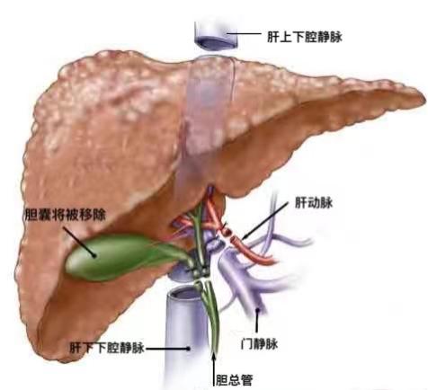 肝癌介入术科普,肝癌移植手术的流程