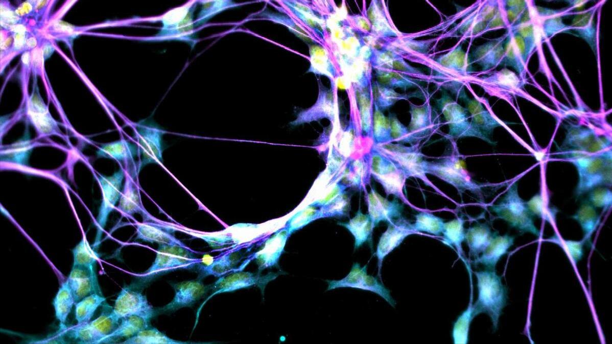 伟哥心脏的副作用停药后能恢复吗,伟哥吃久了有什么副作用