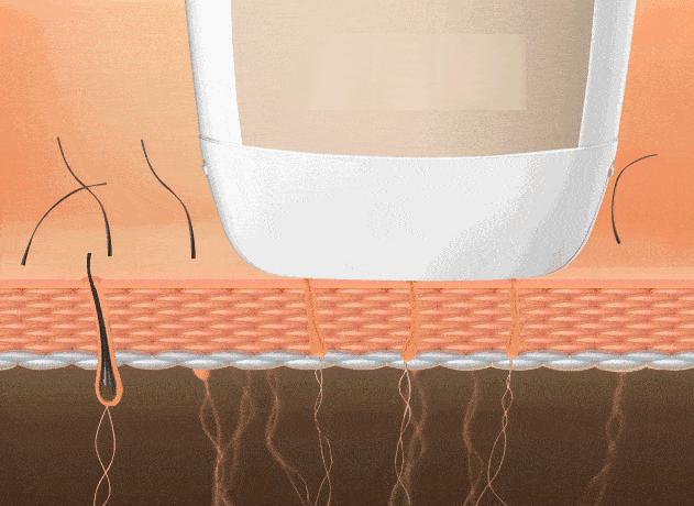 缩毛孔最简单方法,缩毛孔的方法亲身经历