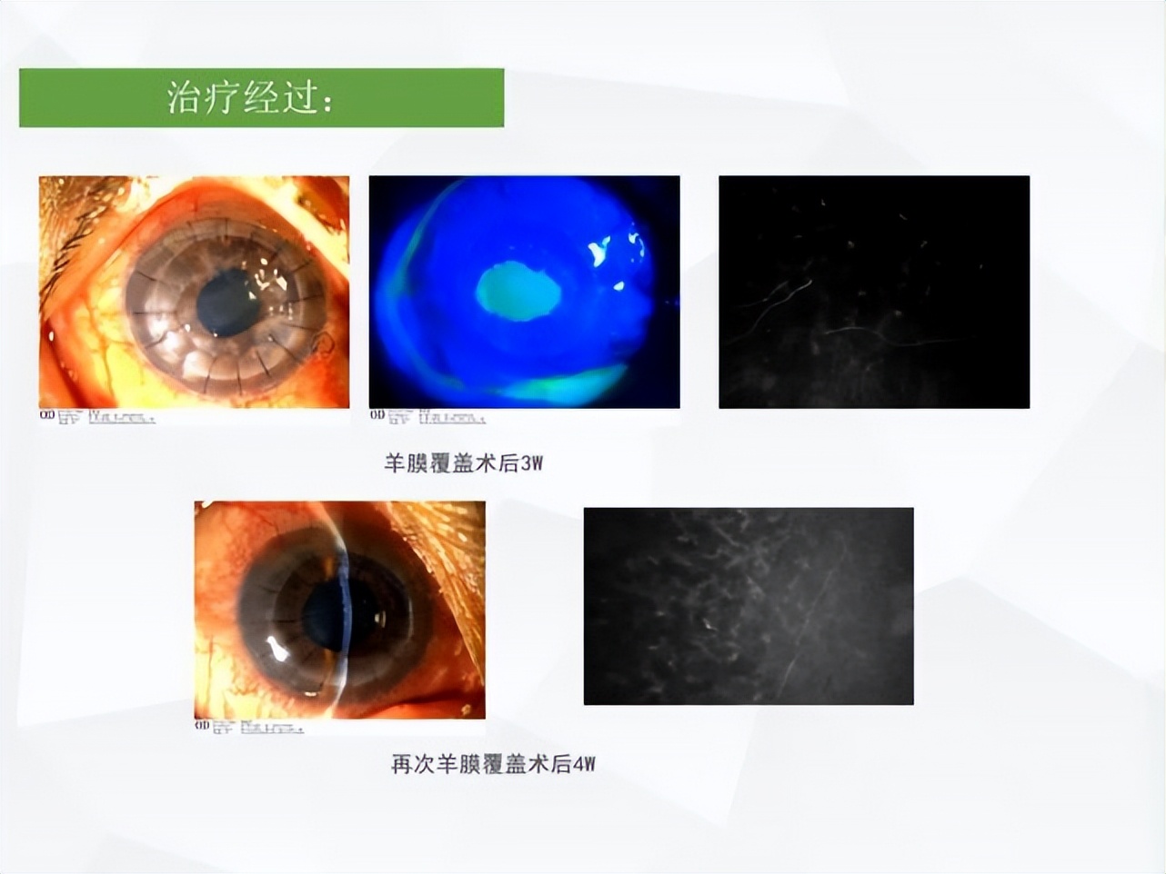 邓志宏几号坐诊,湘雅附三眼科邓志宏简历