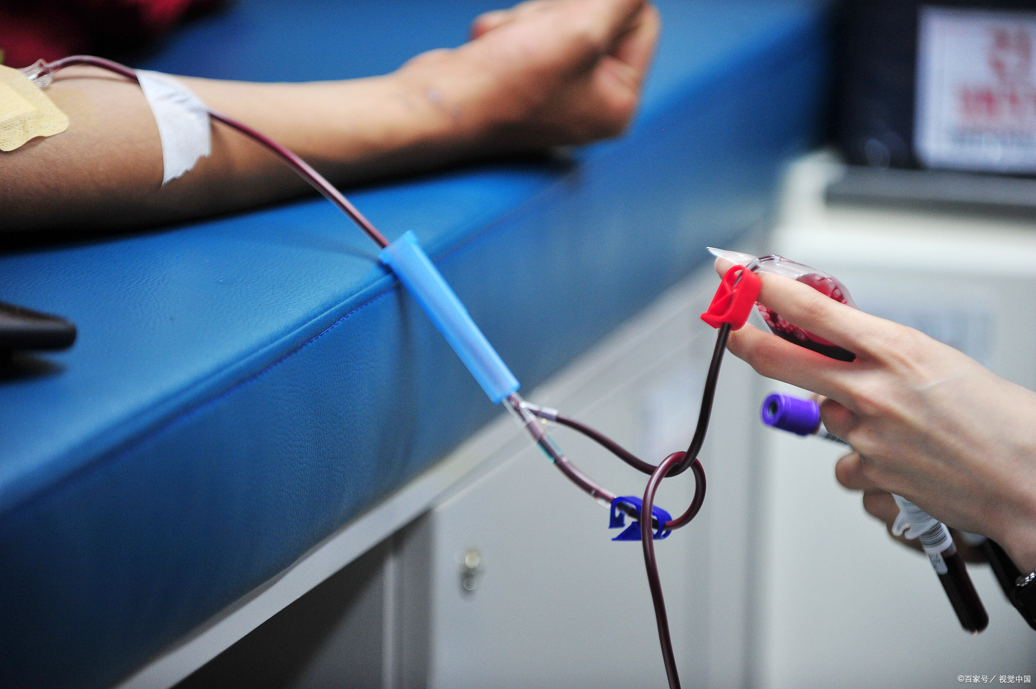 皮肤有这4种迹象当心艾滋病,早期艾滋会出现什么皮肤病