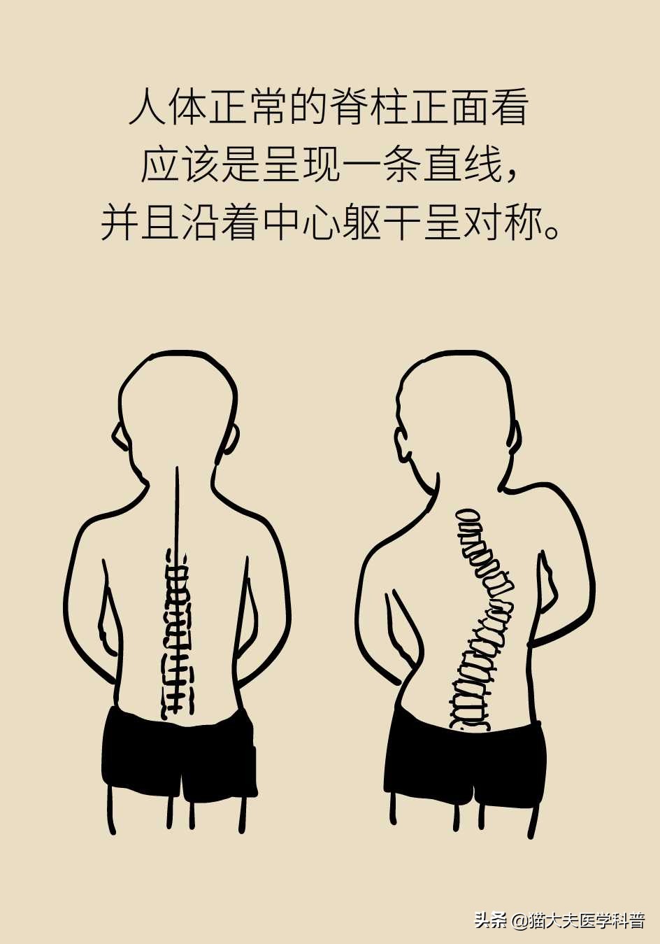 孩子老是驼着背走路感觉没自信,五十岁背有点驼怎么办