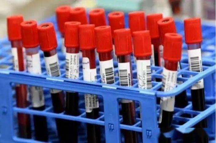 核磁检测有辐射吗,核磁共振检查到底有没有辐射