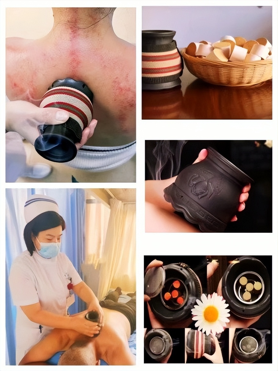 中医康复理疗义诊活动,中医理疗科免费义诊