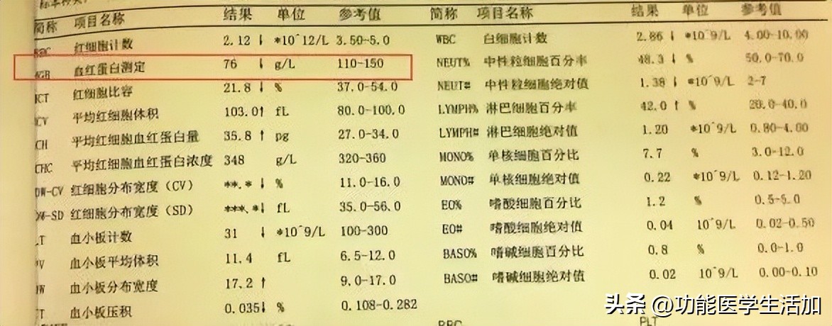 孕期贫血原因及症状及对策,孕期贫血危害与缓解方法