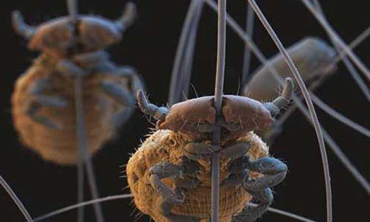 虱子在头上有什么危害,虱子对人体有哪些害处