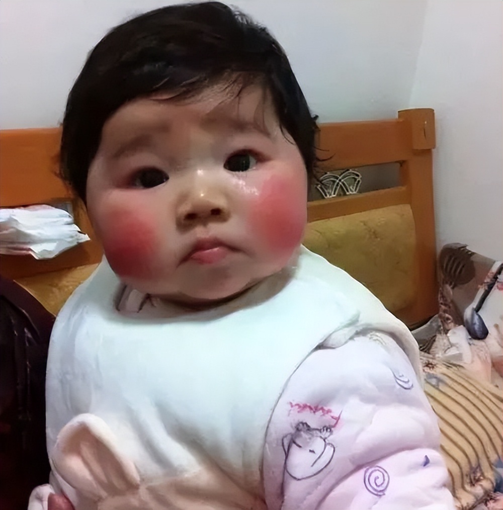 冬季皮肤皲裂,冬季皮肤皲裂怎么办