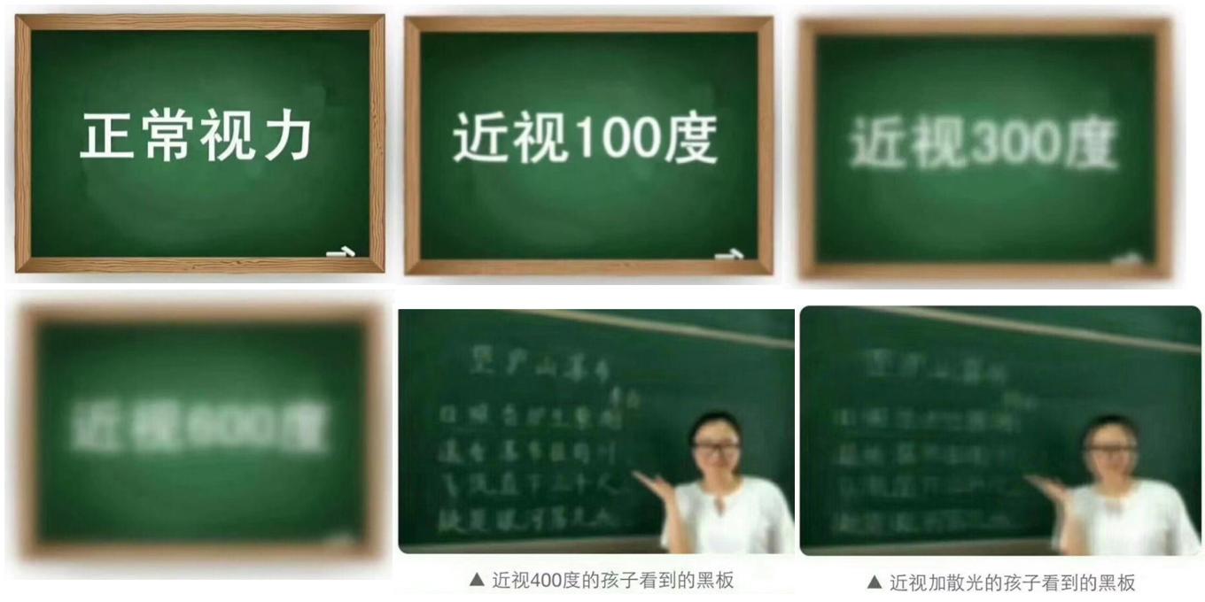 散光严重戴眼镜会有什么感觉,只有散光有必要戴眼镜吗