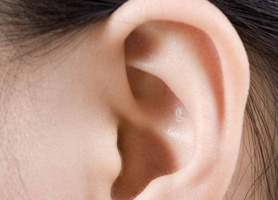 耳朵总是痒痒是身体哪里出问题了,耳朵经常痒得很是什么原因