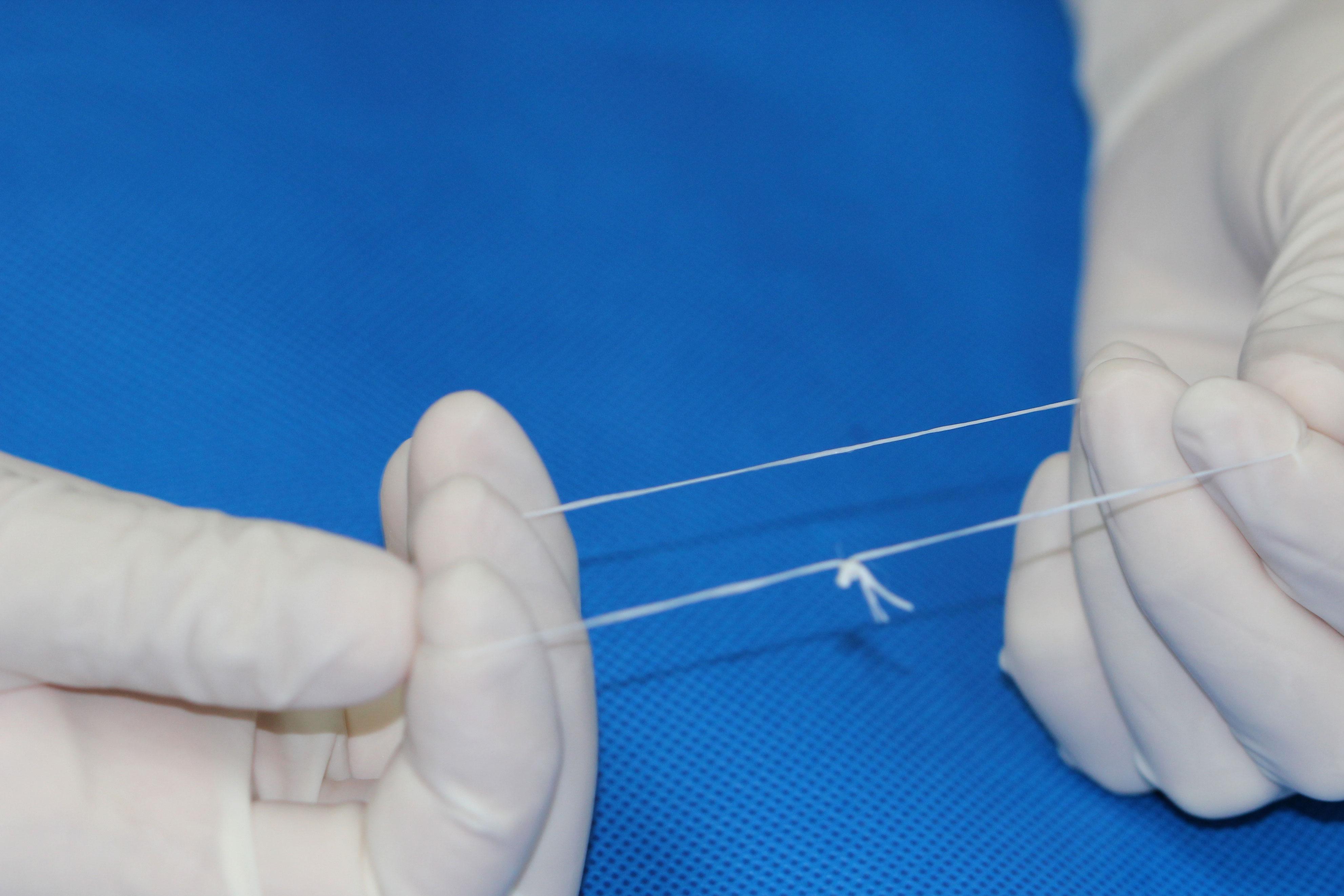 得了甲沟炎一定要拔指甲就能好吗,甲沟炎指甲陷肉里拔不出来怎么办