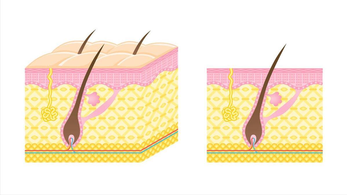 阴毛有什么用？由黑变白说明了性功能减退？男女都需了解