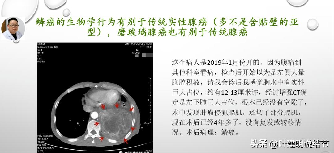 非小细胞肺癌精准检测ppt,关于肺癌的ppt