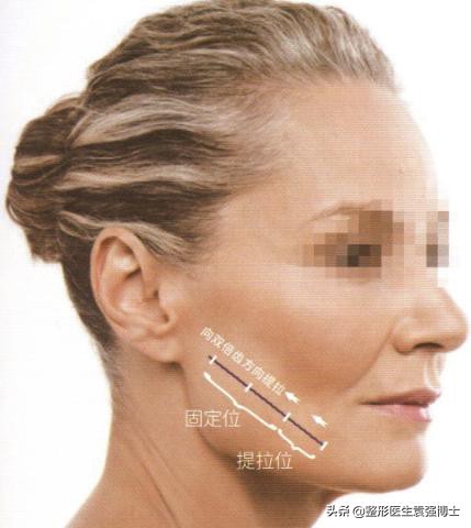 45岁脸下垂怎样锻炼变好看,45岁脸部下垂怎么补救