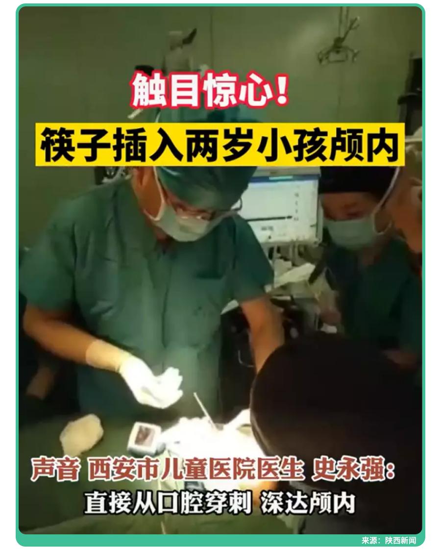 三岁女童玩筷子导致双手被锯,四岁女童不锈钢筷子切掉9根手指