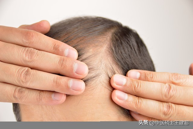 脱发了如何不焦虑,脱发不用慌掉发严重试试这个方法