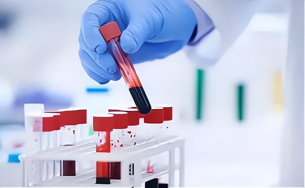 女性体检项目都有哪些,女性体检项目都有什么