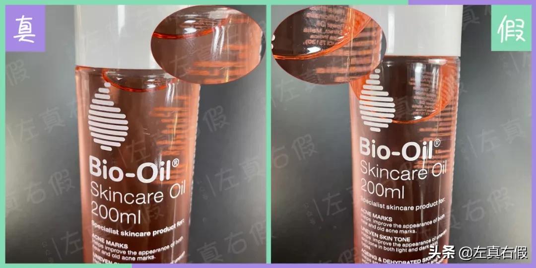 biooil百洛油真假,bio百洛油新包装