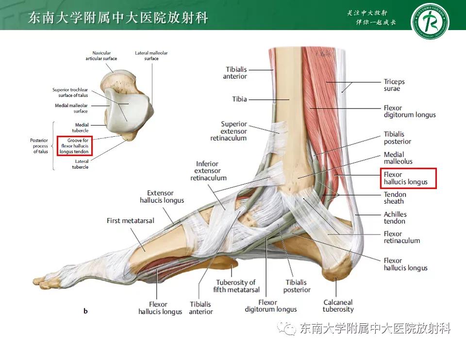 好文分享-《肌骨系统疾病——副舟骨综合征》
