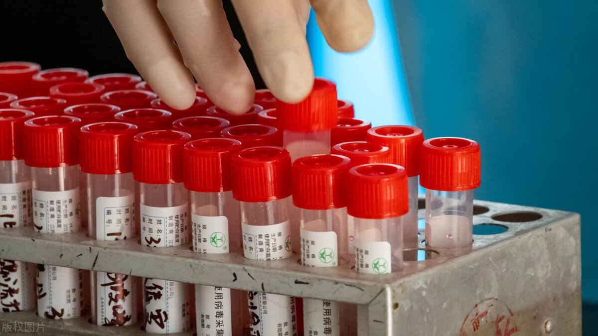 新冠疫情概念,新冠疫情隐藏的发展机会