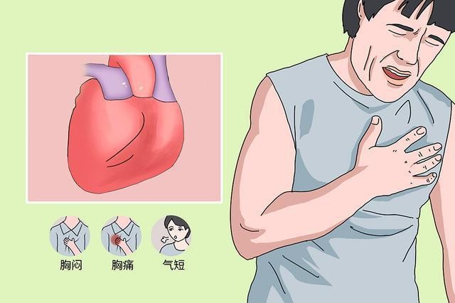 冠脉缺血怎么调理最快最有效,冠脉狭窄性心肌缺血吃什么中成药
