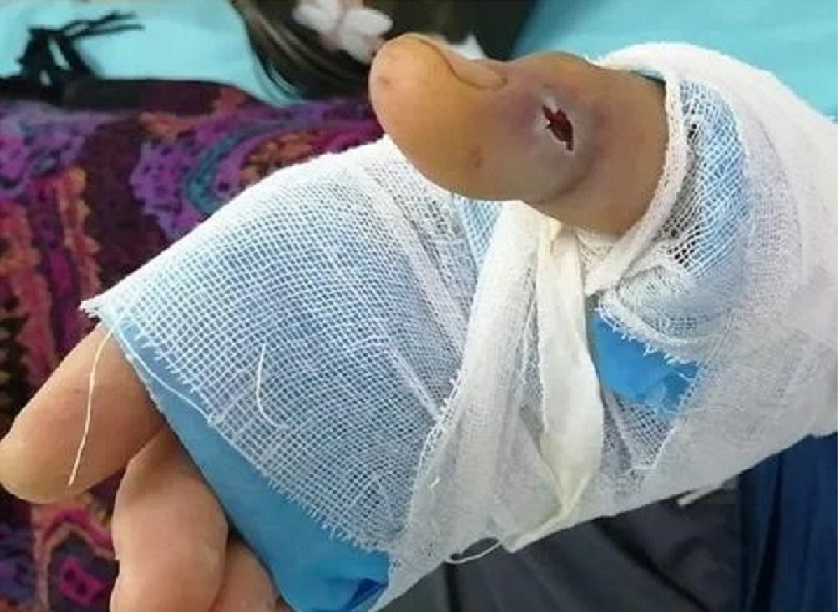 湖北十堰最近发现的蛇,湖北十堰白头蝰