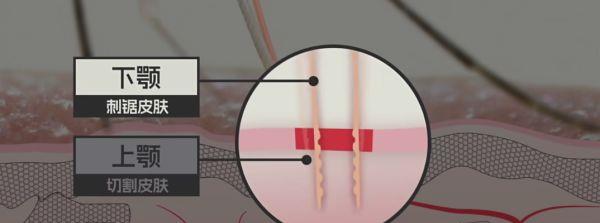 专家研究三十年蚊子,是谁发现蚊子发明了无痛针管