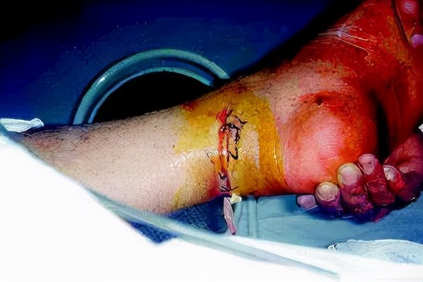 砍双手、割脚筋、杀官员…实名举报=不得好死?