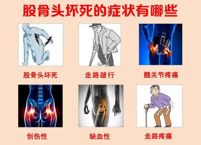 髋关节疼痛自我解决方法,治疗髋关节疼痛的偏方
