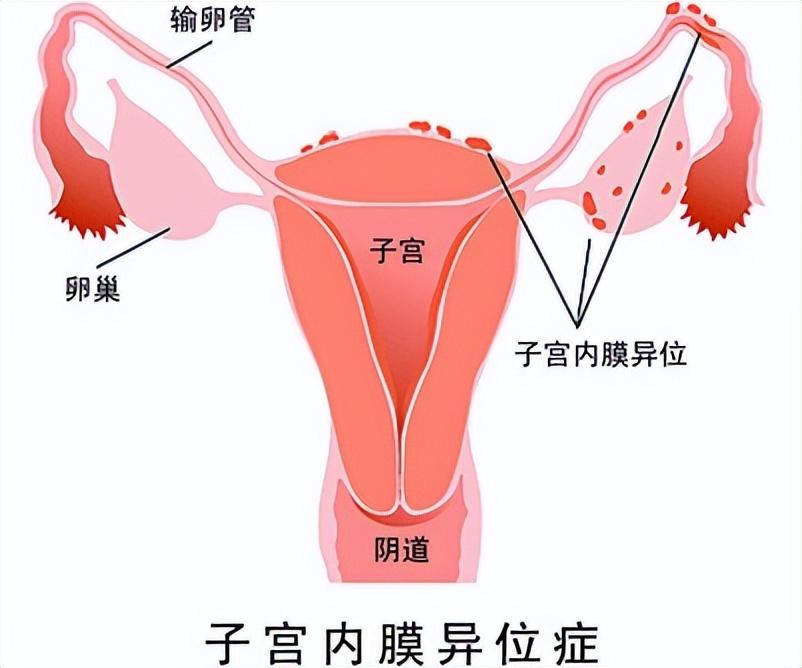 姨妈前后外阴有点疼是怎么回事,女士下身隐隐疼怎么回事