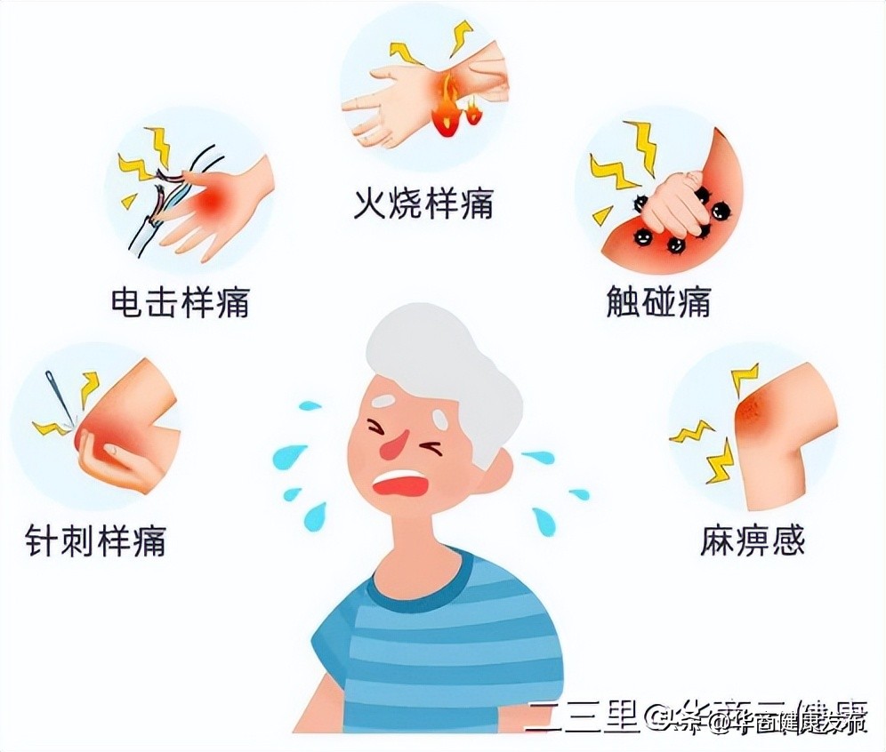 疱疹神经痛科普视频,带状疱疹疼痛处理专家共识