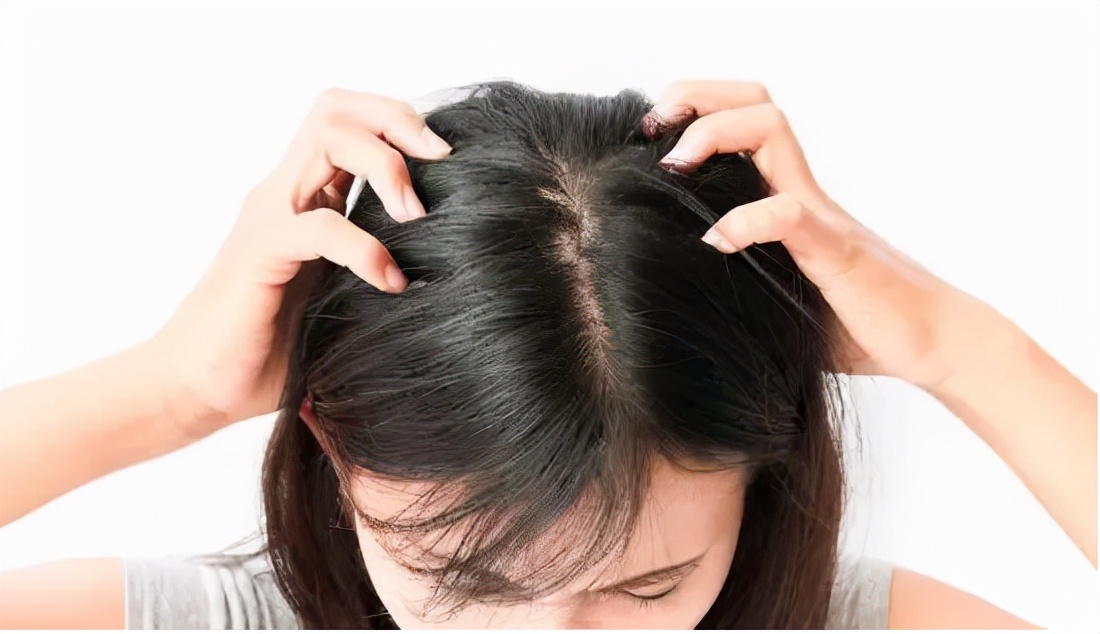 头发细软油头脱发怎么治疗,脂溢性脱发去生发养发馆有用吗