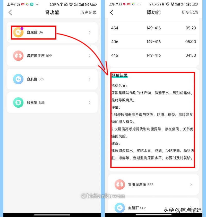 无需扎手检测血糖手表,无需采血自动测糖仪