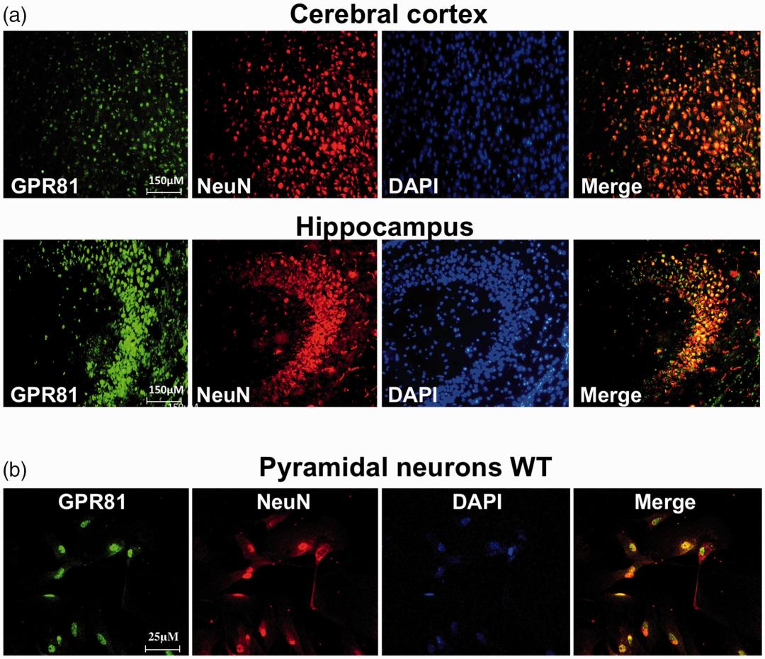 誉嘉医学文献分析｜新生儿缺氧缺血性脑损伤后还可以恢复吗？能