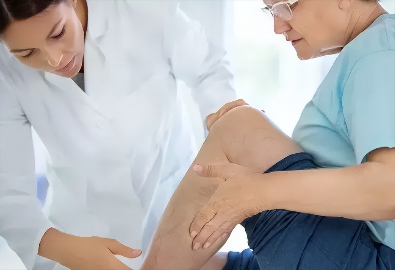 快速消除腿部静脉曲张的穴位,静脉曲张蚯蚓腿怎么治疗