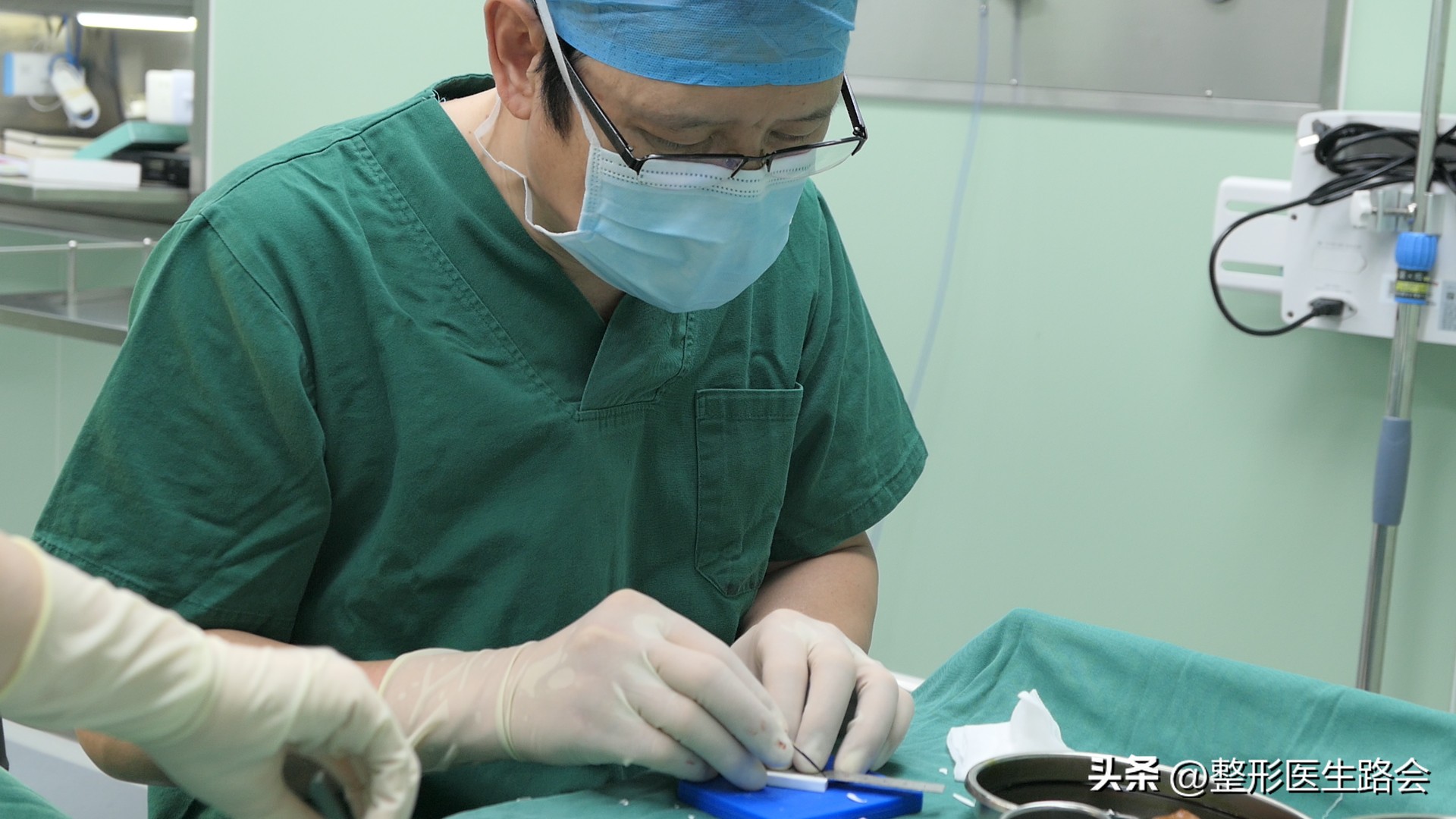 法令纹鼻基底填充靠谱吗,鼻基底填充可以祛法令纹吗