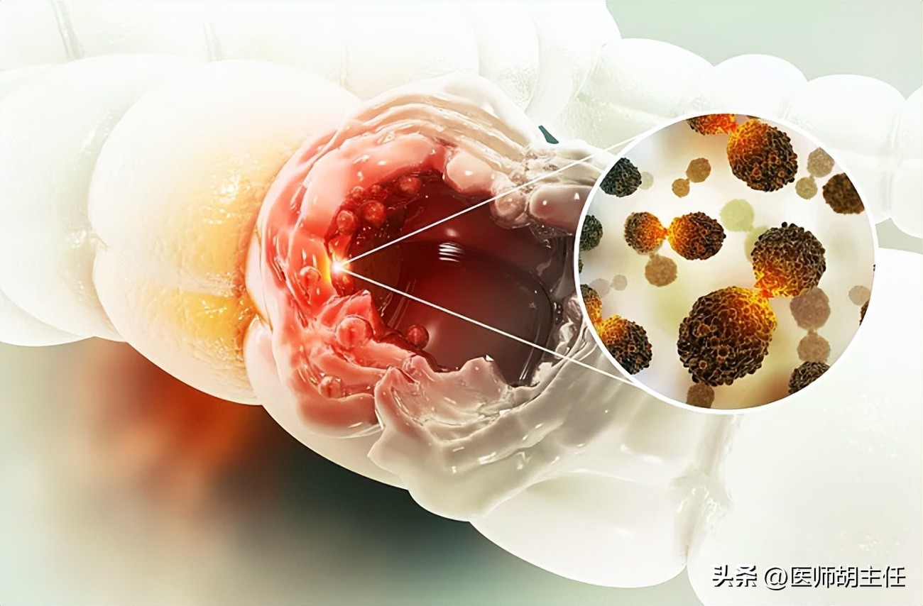 中老年人补充叶酸哪种牌子好,中老年白发补充叶酸有用吗
