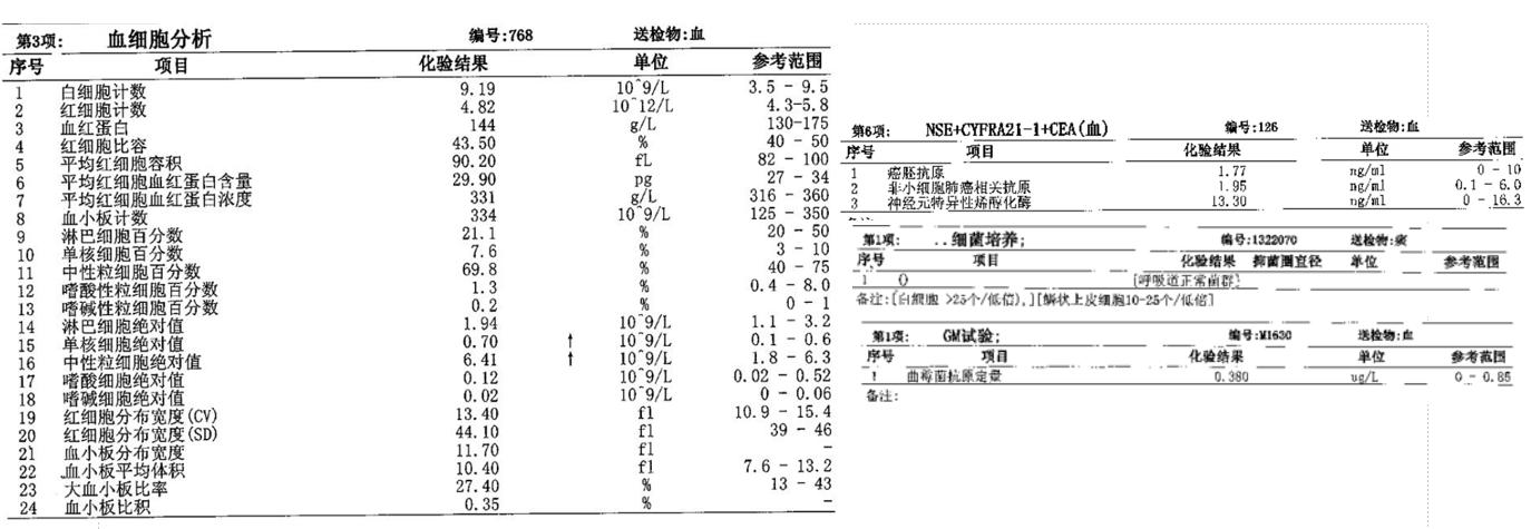 肉芽肿性血管炎ct表现,嗜酸性肉芽肿性血管炎症状