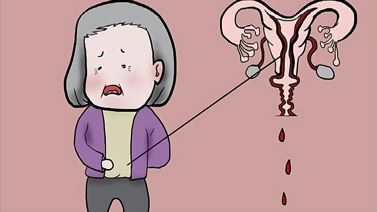 女人的子宫往下掉怎么治疗,女人老了子宫脱落的症状