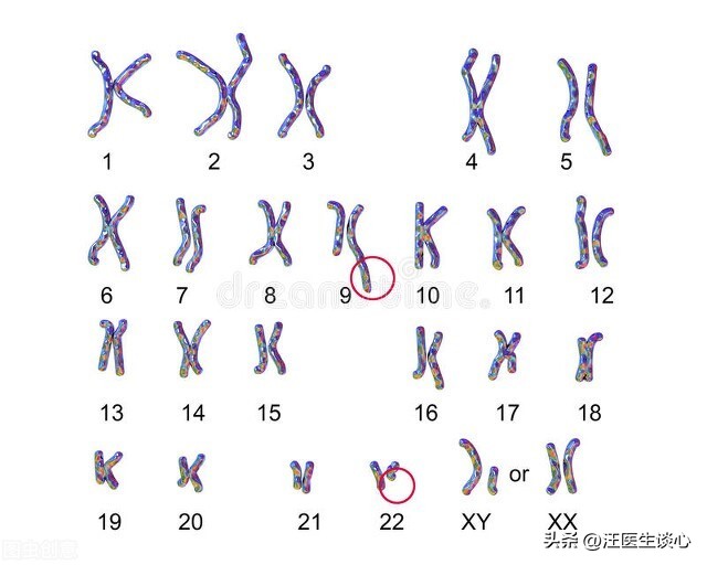 费城染色体阳性的急性髓系白血病,慢性粒细胞白血病的染色体标记