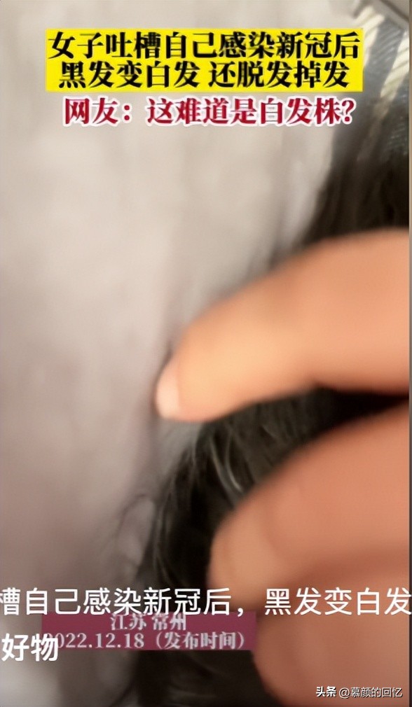 目前的5种毒株,毒株不一样都有哪一种毒株最厉害