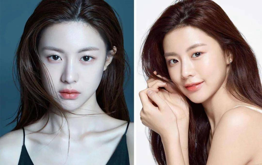 整鼻前后对比,整鼻技术有哪些