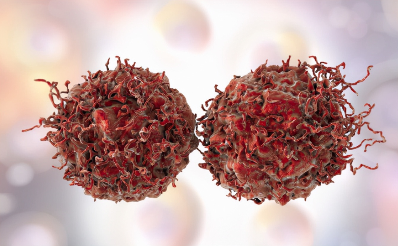 女性肛周瘙痒是癌吗,肛周瘙痒是直肠癌吗