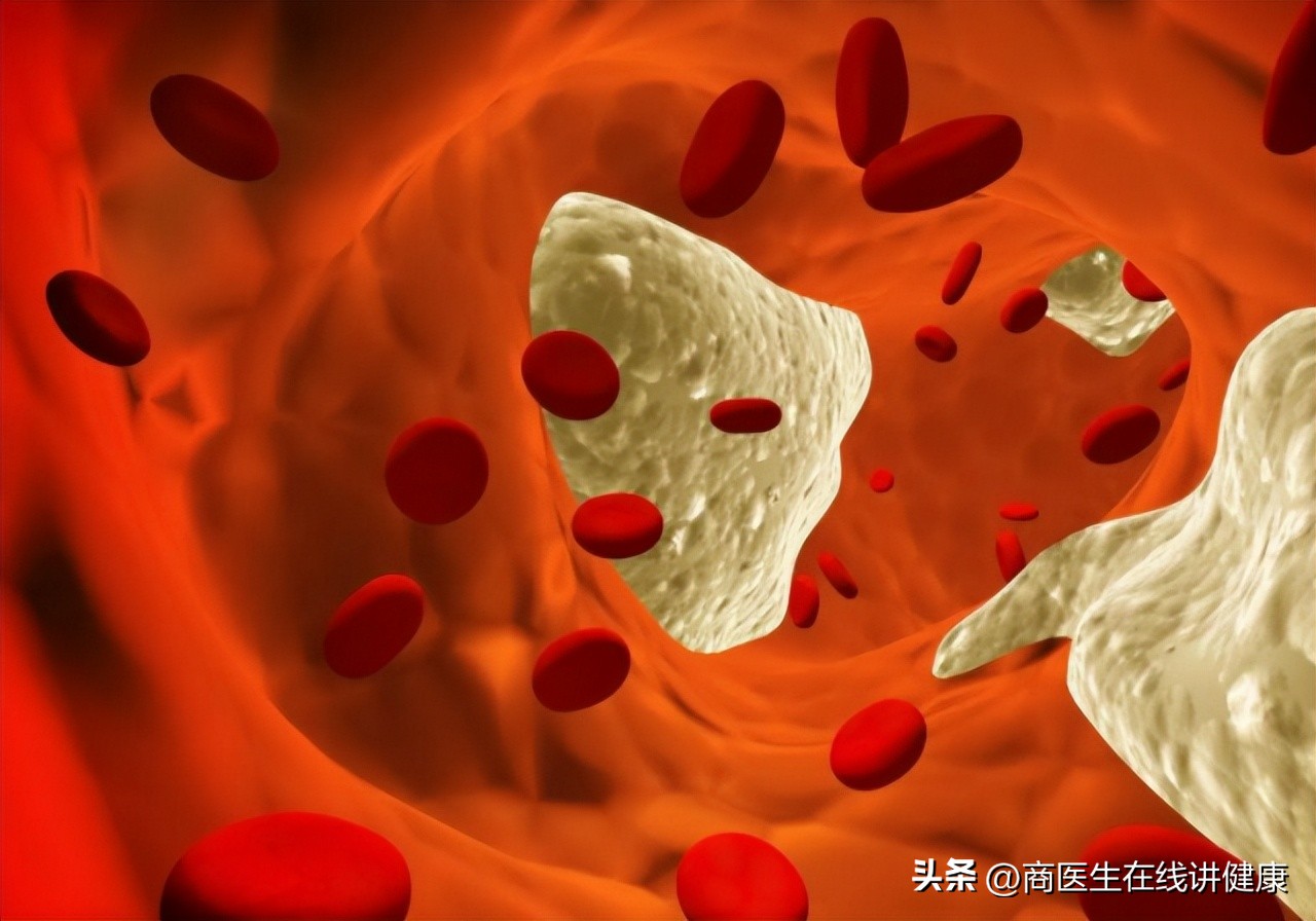 面对*生活性**，糖尿病患者该怎么办？科学调理，医生给您想办法