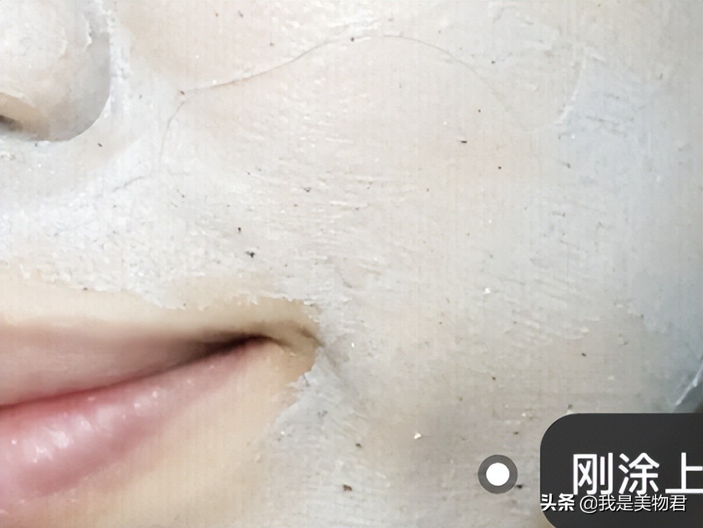 改善毛孔堵塞闭口粉刺,毛孔清道夫去闭口粉刺